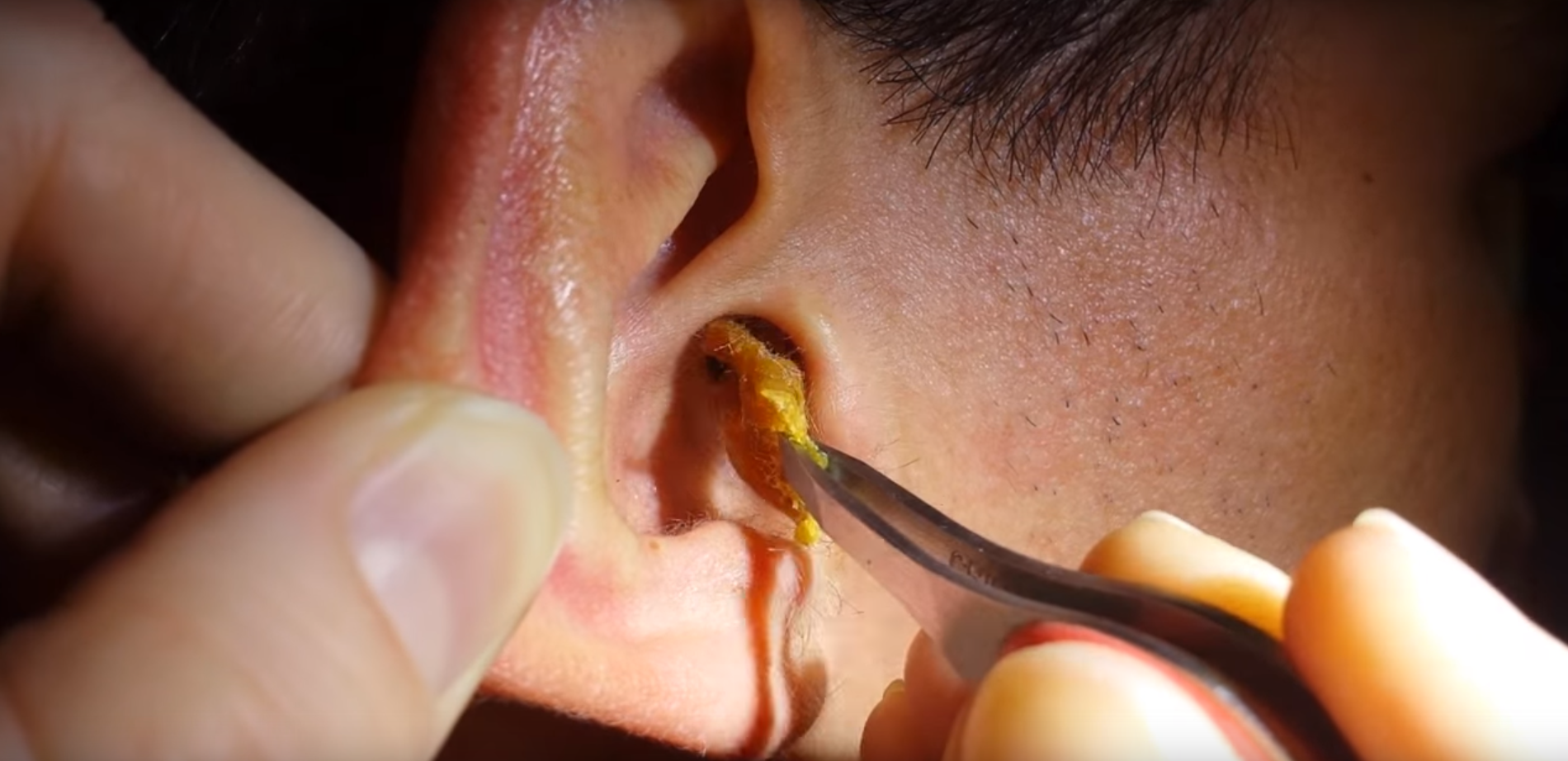 Where Does Ear Wax Come From 105